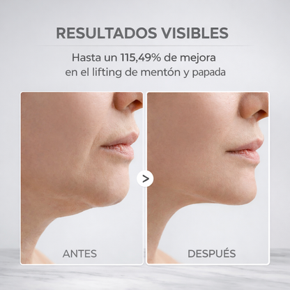 Mascarilla V-Lift para Cuello y Papada (Efecto Lifting)