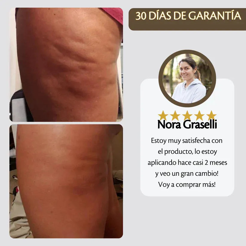Aceite Anticelulítico Reafirmante PosturePlus™️