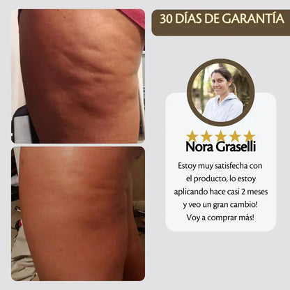 Aceite Anticelulítico Reafirmante PosturePlus™️